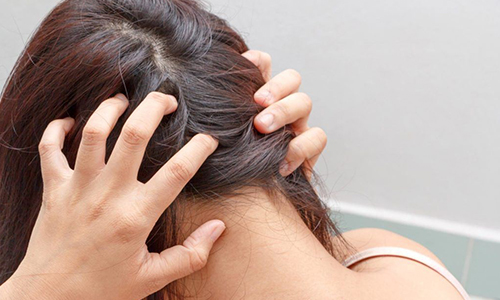 Средства и препараты для лечения волос от выпадения и поредения